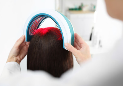 Understanding Low-Level Laser Therapy for Hair Growth
